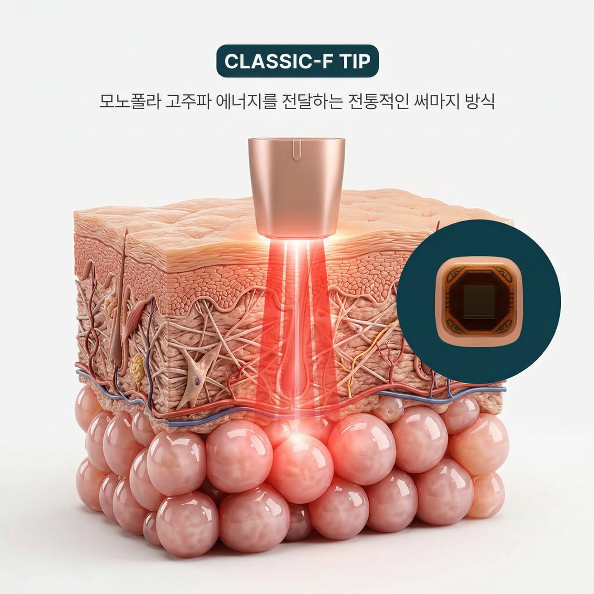 Classic Tip